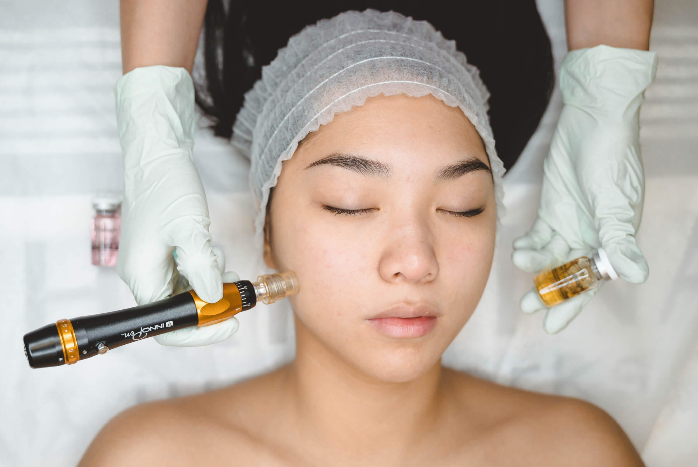 Microneedling